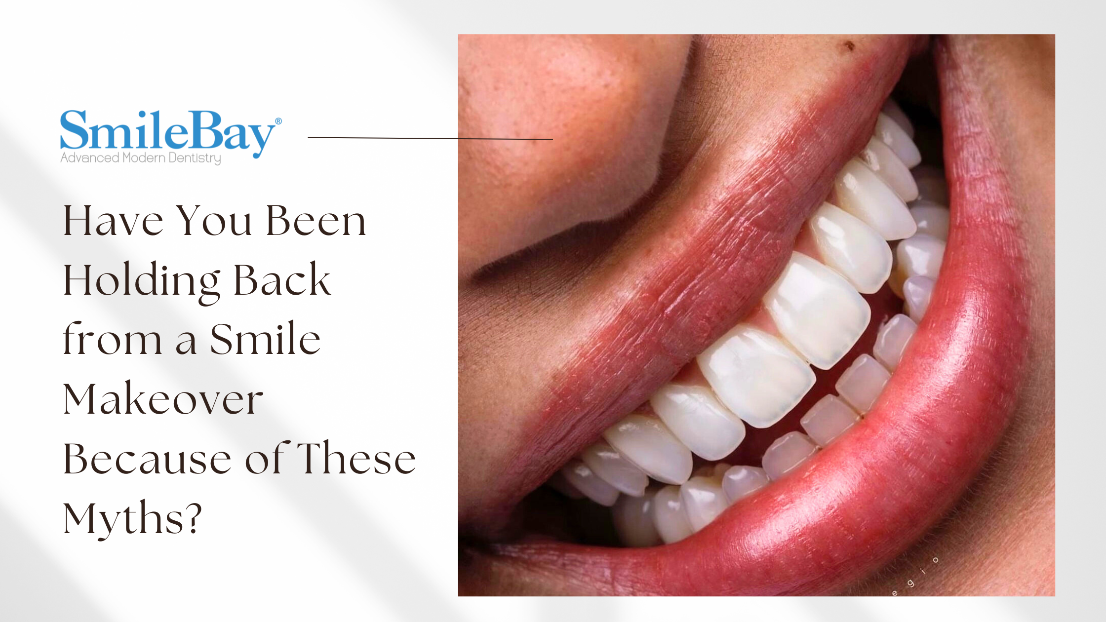 Close-up of a person smiling with straight, white teeth after a smile makeover at SmileBay Dental.