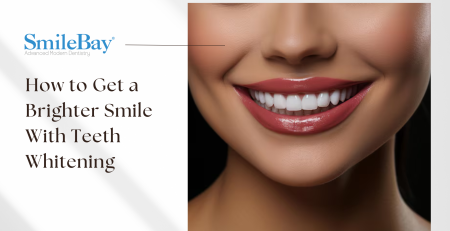 Close-up of a woman’s bright white smile after professional teeth whitening, promoting SmileBay Dental’s whitening treatments in Penang.