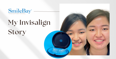 SmileBay patient before and after Invisalign treatment in Penang