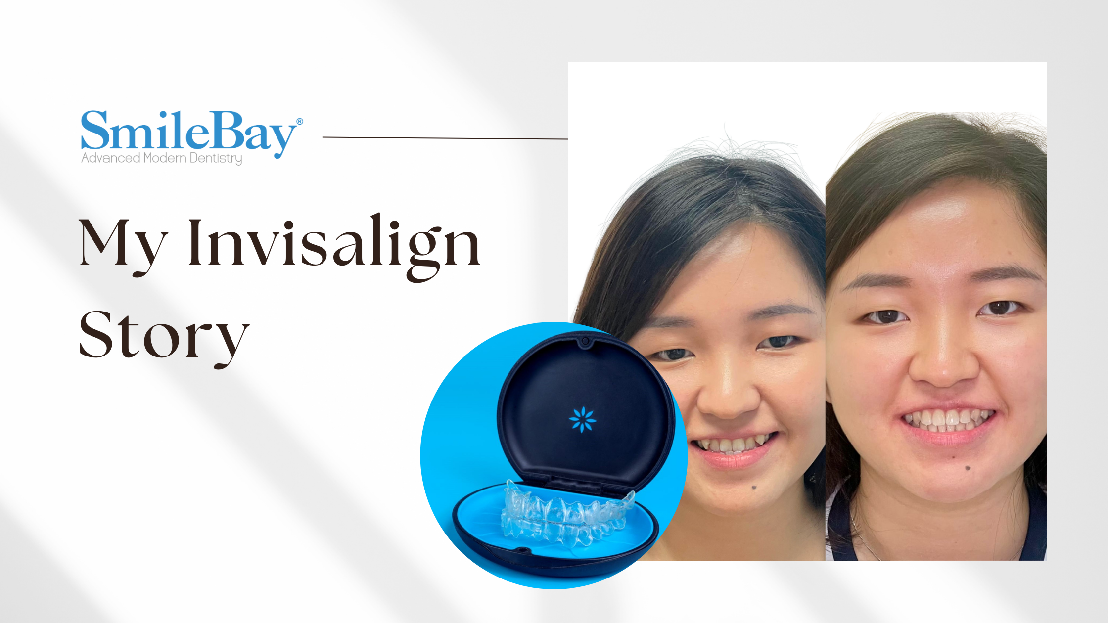 My Invisalign Story - SmileBay Dental